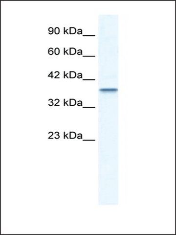 Anti-MTA1 (AB2) antibody produced in rabbit