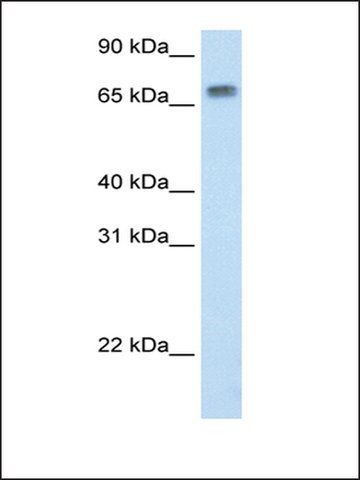 Anti-MTA2 (AB4) antibody produced in rabbit