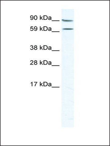 Anti-MTA2 (AB1) antibody produced in rabbit