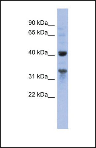 Anti-MRPL37, (N-terminal) antibody produced in rabbit