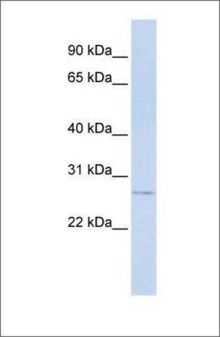 Anti-MTHFS antibody produced in rabbit
