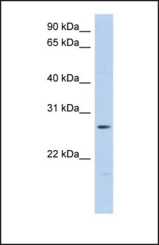 Anti-MTHFS antibody produced in rabbit