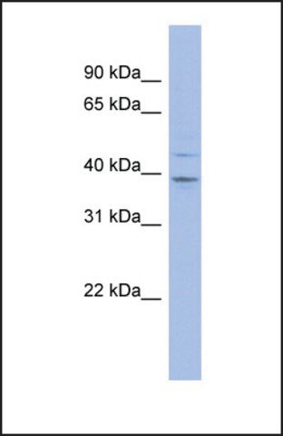 Anti-MTHFSD, (N-terminal) antibody produced in rabbit