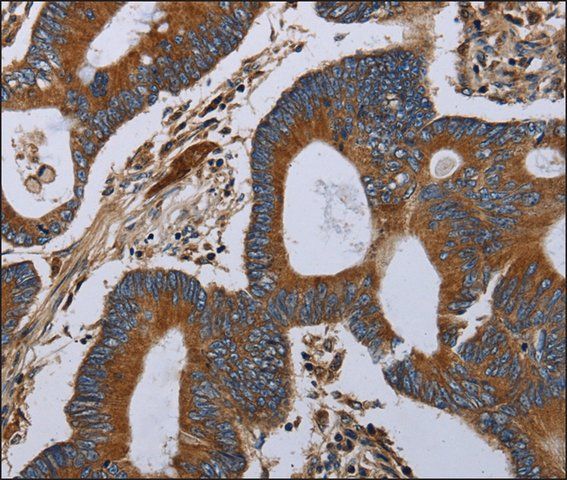 Anti-MT-ND6 antibody produced in rabbit