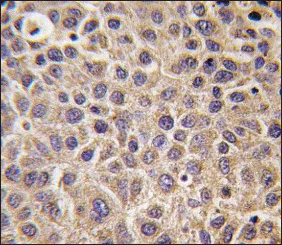 Anti-MTMR8 (C-term) antibody produced in rabbit