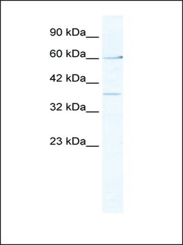 Anti-MTA1 (AB1) antibody produced in rabbit