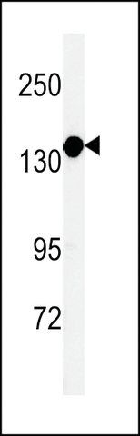 ANTI-MTMRF (N-TERMINAL) antibody produced in rabbit