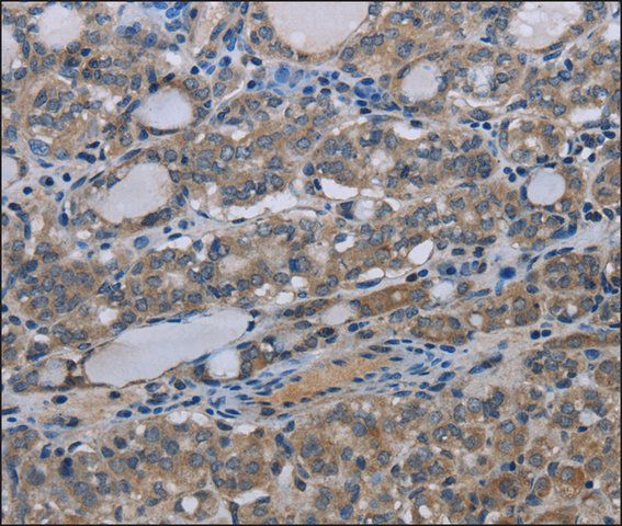 Anti-MT-ND3 antibody produced in rabbit