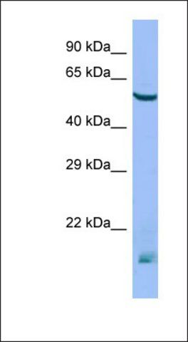Anti-MTM1 antibody produced in rabbit