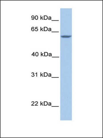 Anti-MTL5 antibody produced in rabbit