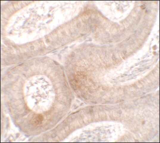 Anti-MTERFD3 antibody produced in rabbit