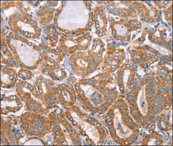 Anti-MTMR7 antibody produced in rabbit