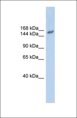 Anti-NCOA3, (N-terminal) antibody produced in rabbit