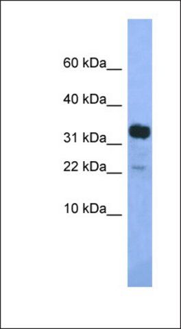 Anti-KLHDC9 antibody produced in rabbit