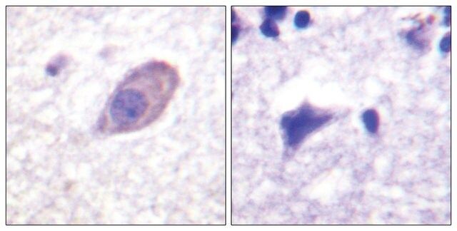 Anti-Kir5.1 (Ab-416) antibody produced in rabbit