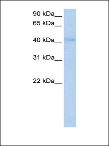 Anti-KLHDC5 antibody produced in rabbit