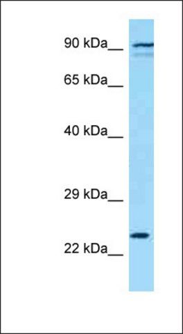 Anti-KLRK1 antibody produced in rabbit