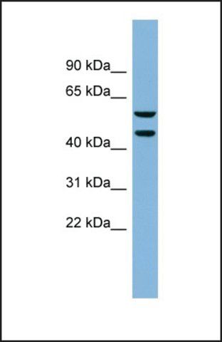 Anti-KLHDC4, (N-terminal) antibody produced in rabbit