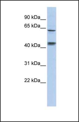 Anti-KLHL8 antibody produced in rabbit