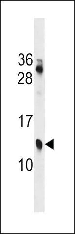ANTI-KLKP1(N-TERMINAL) antibody produced in rabbit