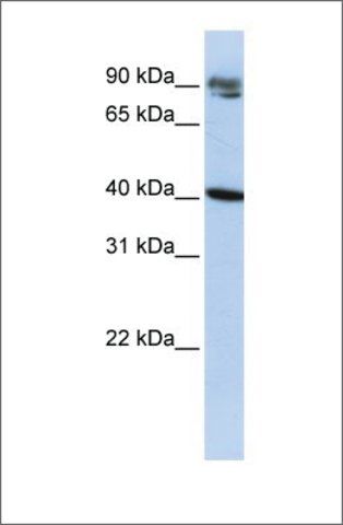 Anti-KLHDC8A antibody produced in rabbit