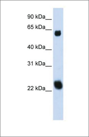 Anti-KLHL26 (ab1) antibody produced in rabbit