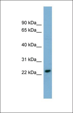 Anti-KLRC3, (N-terminal) antibody produced in rabbit