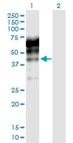 Anti-KNG1 antibody produced in rabbit