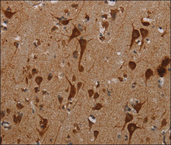 Anti-KMT2D antibody produced in rabbit