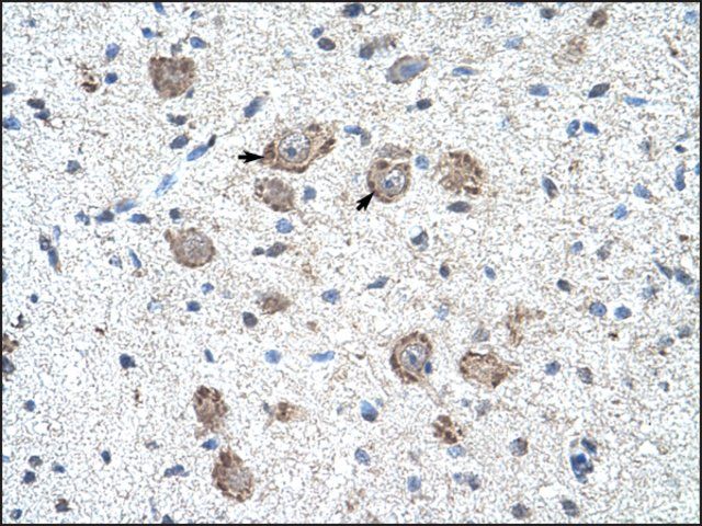 Anti-KLHL25 antibody produced in rabbit