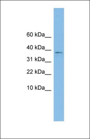 Anti-KLHDC9 antibody produced in rabbit