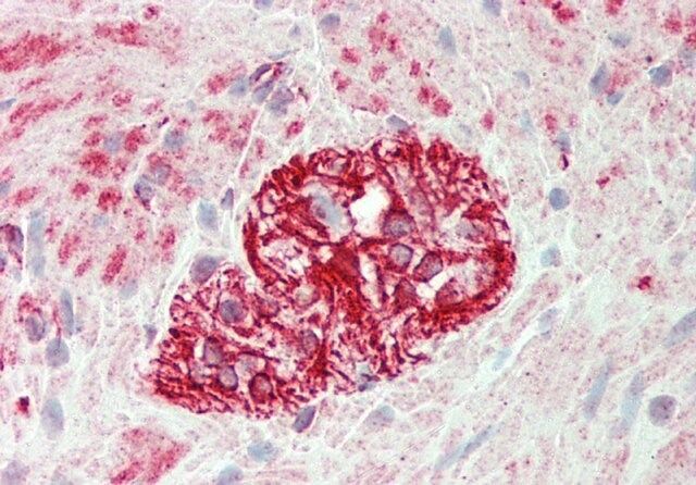Anti-KLHL25 antibody produced in rabbit