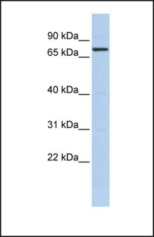 Anti-KLHL5, (N-terminal) antibody produced in rabbit