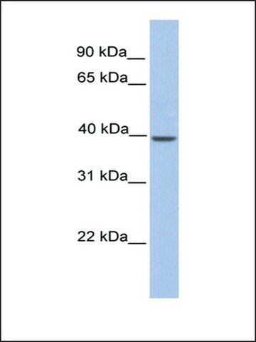 Anti-KLKBL4 antibody produced in rabbit