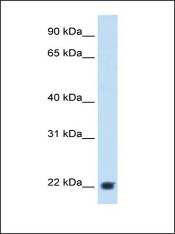 Anti-KLKB1 antibody produced in rabbit