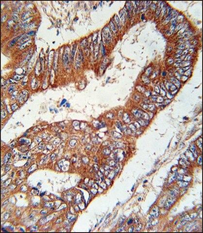 ANTI-KLHL6 (C-TERM) antibody produced in rabbit