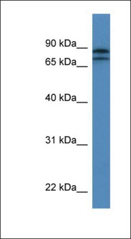 Anti-KLHL22 antibody produced in rabbit