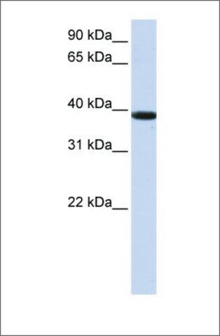 Anti-KLHDC8B antibody produced in rabbit