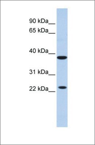 Anti-KLRA1 (ab2) antibody produced in rabbit