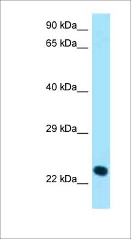 Anti-KLRK1 antibody produced in rabbit
