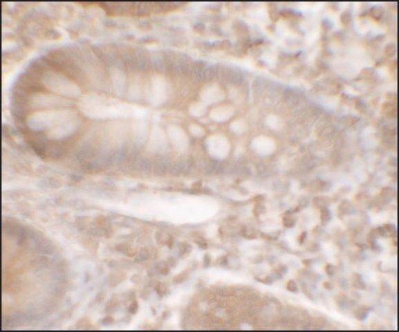 Anti-KREMEN1 antibody produced in rabbit