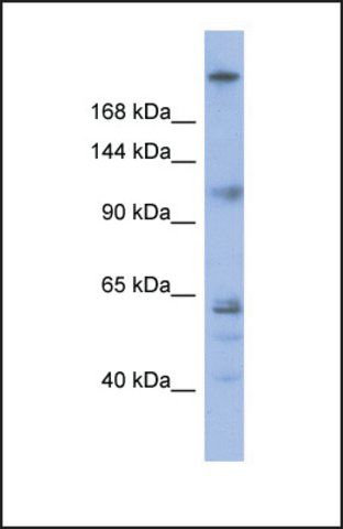 Anti-KNTC1, (N-terminal) antibody produced in rabbit