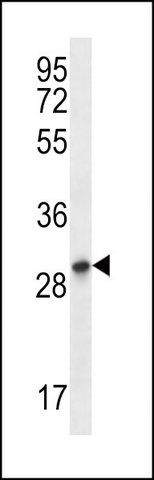 ANTI-KRT222P (C-TERM) antibody produced in rabbit
