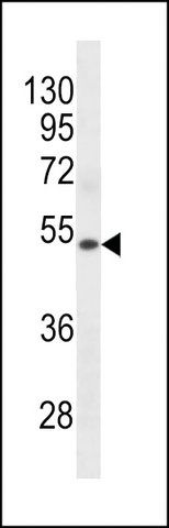 ANTI-KRT72 (CENTER) antibody produced in rabbit
