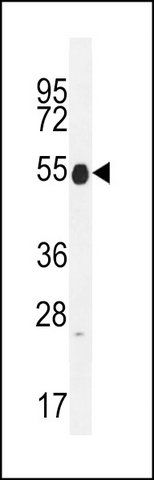ANTI-KRT25 (C-TERM) antibody produced in rabbit