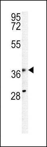 ANTI-KPRA (N-TERM) antibody produced in rabbit
