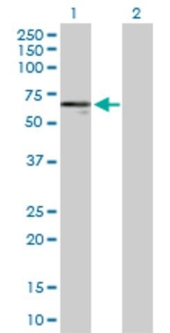 Anti-KRT14 antibody produced in rabbit
