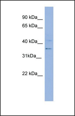 Anti-KRT13, (N-terminal) antibody produced in rabbit