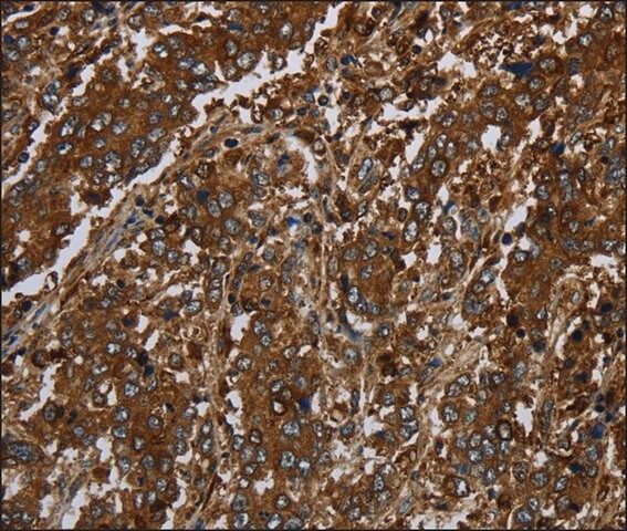 Anti-KLRF1 antibody produced in rabbit