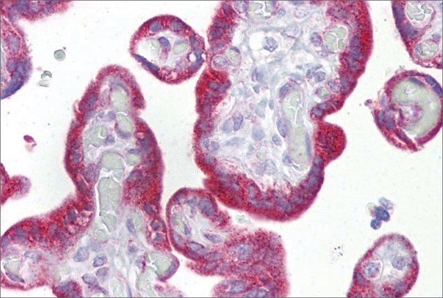 Anti-KRT23 antibody produced in rabbit